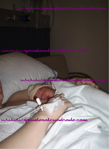 lactancia materna después de cesárea