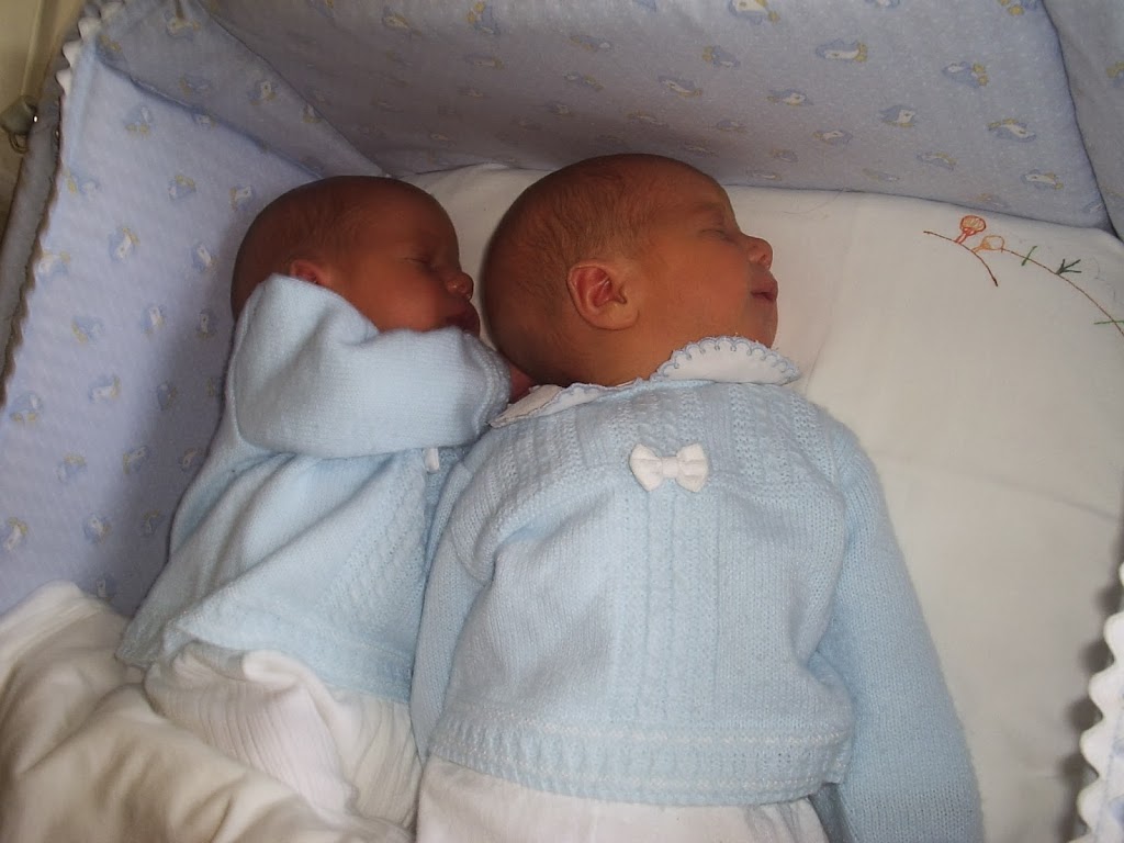 ictericia patológica con gemelos y lactancia materna
