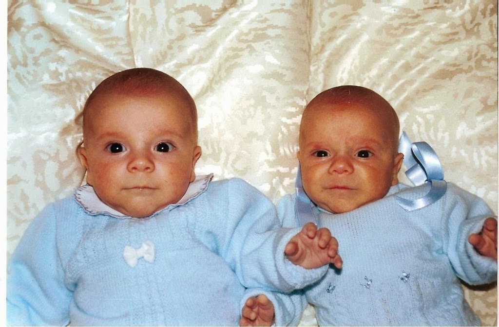 gemelos con bajo peso al nacer